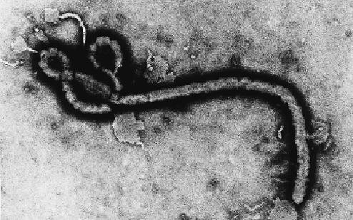 Великобритания. Еще один зараженный вирусом Эбола?