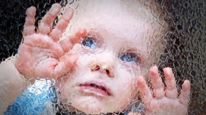 Ученые: Движение глаз младенца может помочь выявить аутизм.