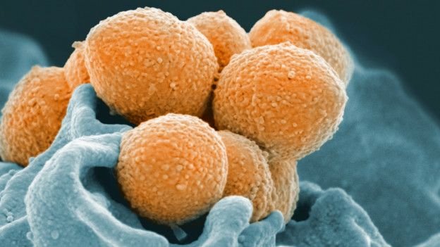 В домашней пыли нашли 9000 видов микробов