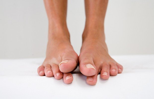 Ученые выяснили, почему люди не чувствуют пальцев ног.