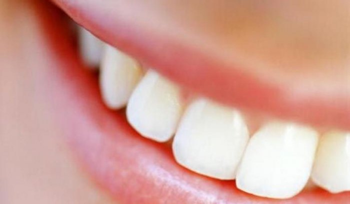 У древних римлян зубы были здоровее, чем у современных людей