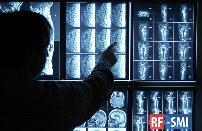 Рентгенологи Москвы стали в полтора раза чаще пользоваться искусственным интеллектом
