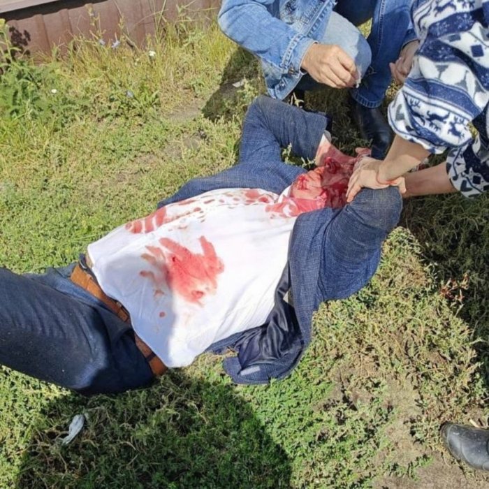 В Пензенской области избили металлической трубой главу района из-за спора о бане В Пензенской области избили металлической трубой главу района из-за спора о бане