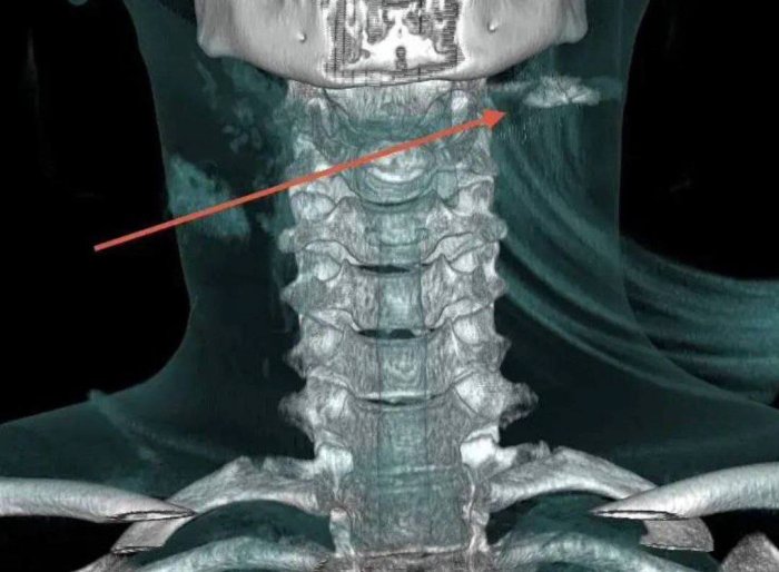 ���������  ���������� ���� � ��� �� ��������������� ���������