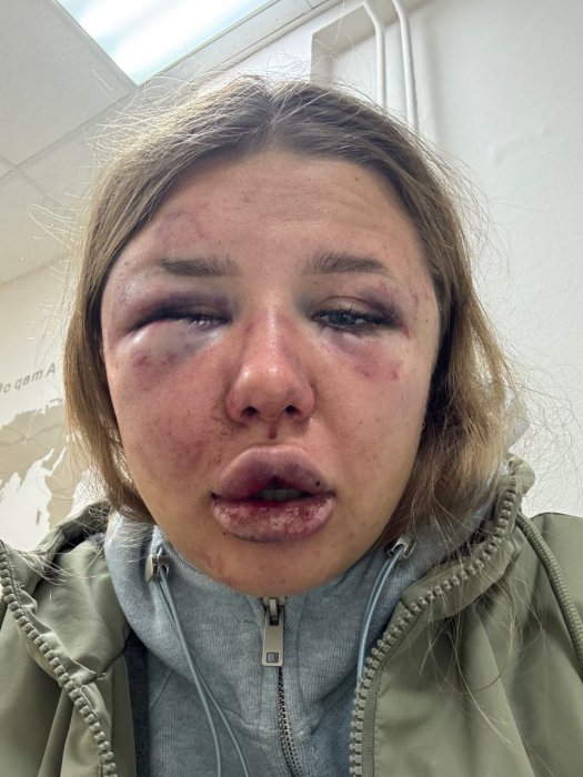 ������� ���������� ������ ��������������, ������� ��������� ���� �������