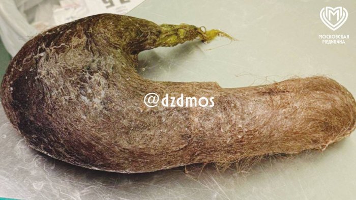 �������� ���� ����� ������� �� ������� ���������� ������